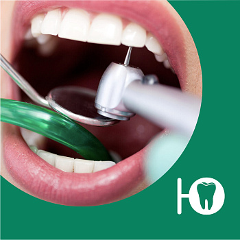 Лечение пульпита трехканального зуба
